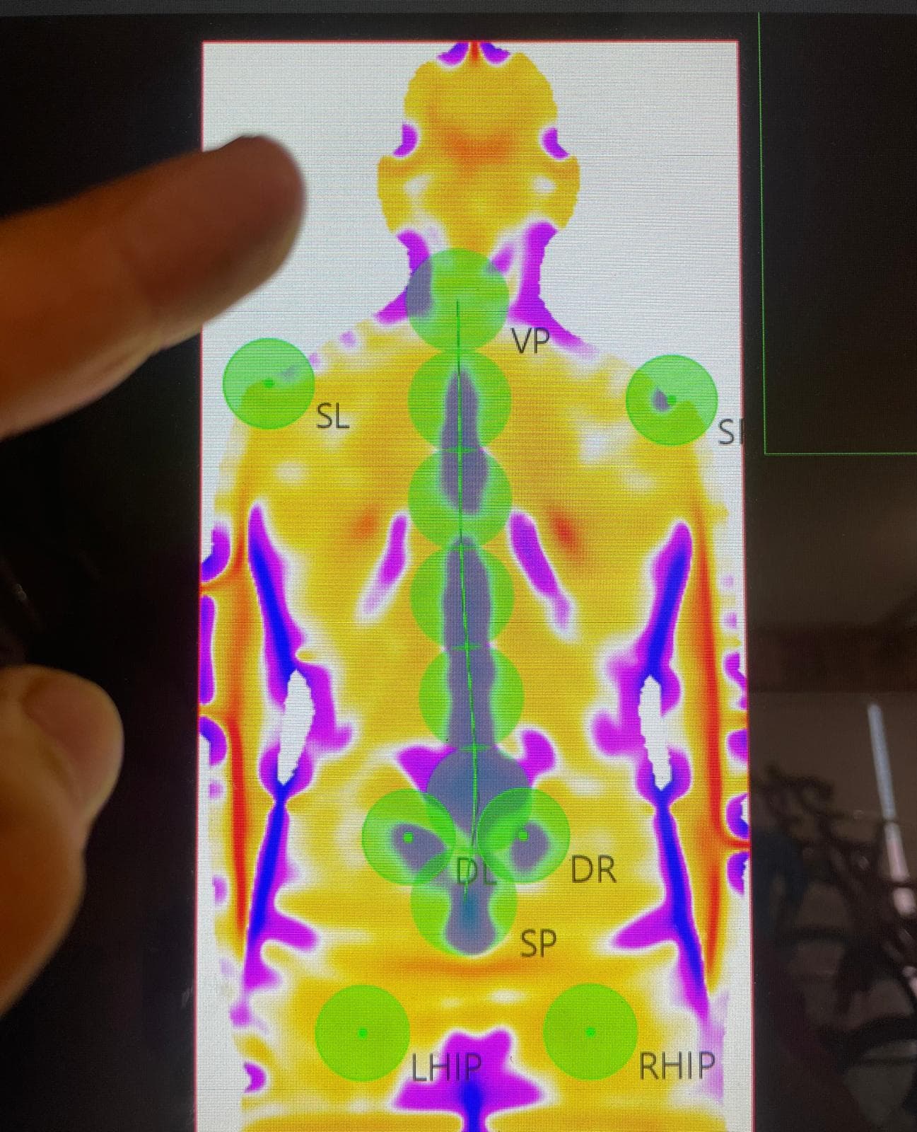 Thermografie van de rug met meetpunten
