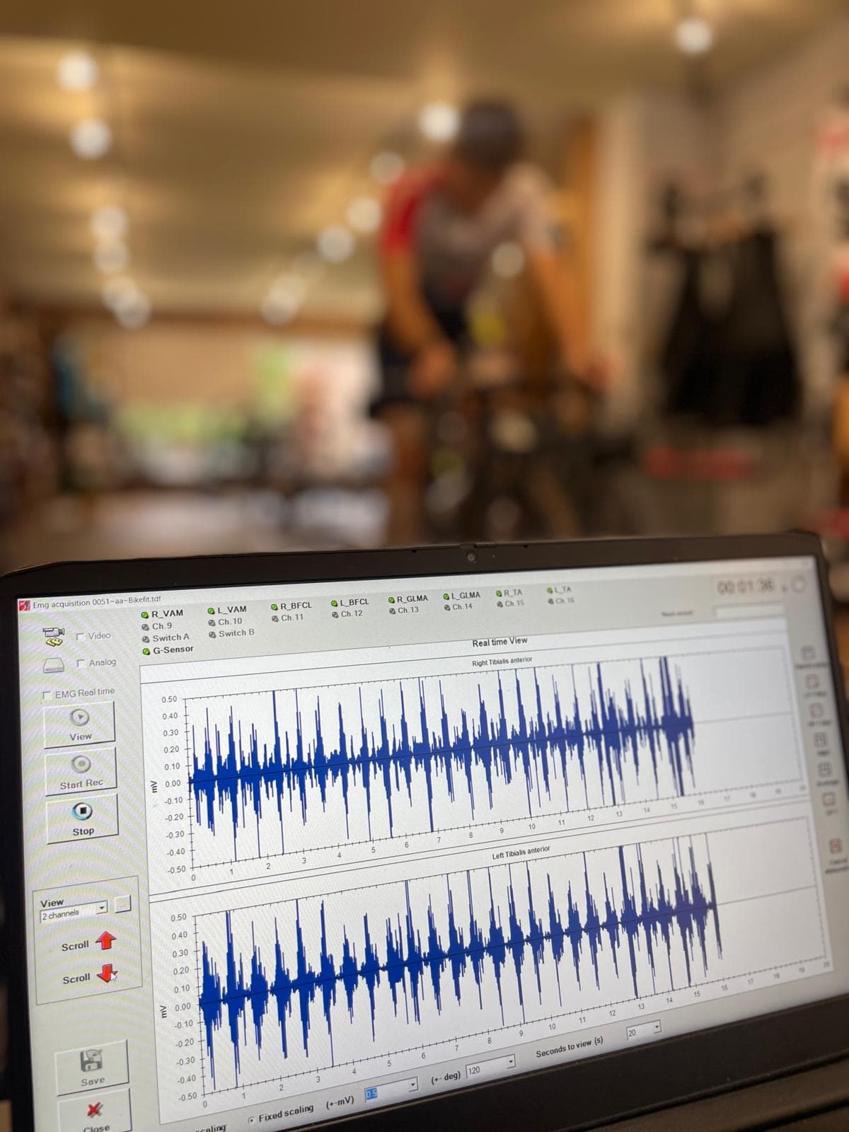 sEMG-spieractivatie live gemeten tijdens een fit in het BikeLab